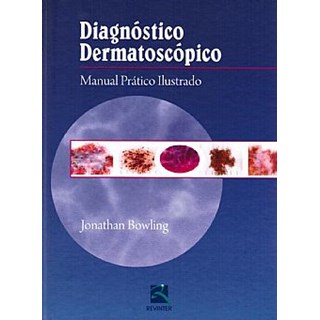 Livro - Diagnóstico Dermatoscópico - Manual Prático Ilustrado - Bowling