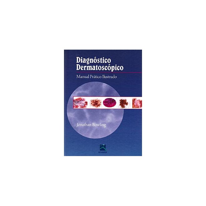 Livro - Diagnóstico Dermatoscópico - Manual Prático Ilustrado - Bowling