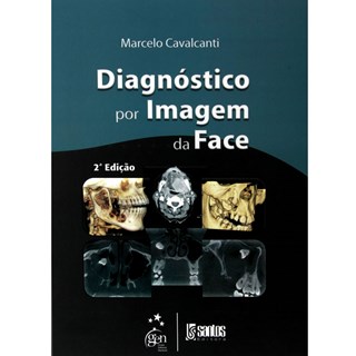 Livro - Diagnóstico por Imagem da Face - Cavalcanti