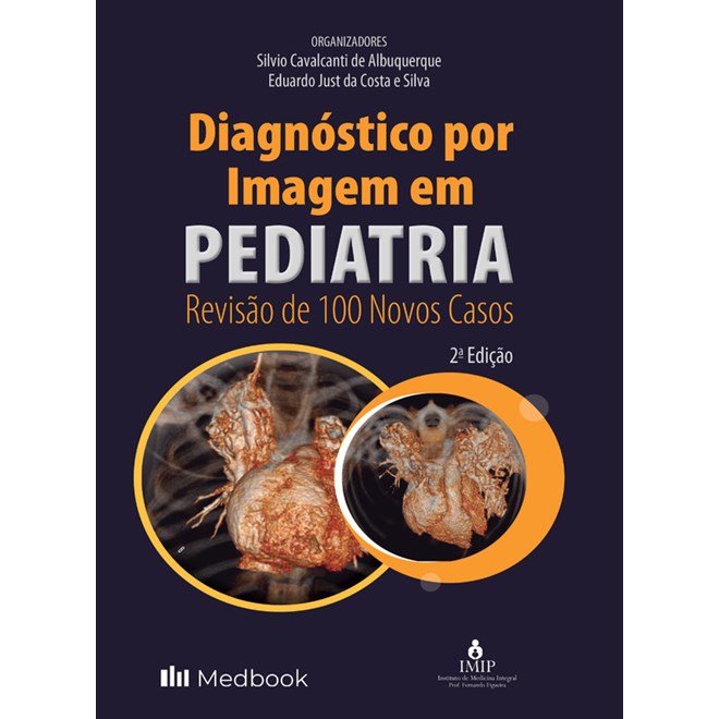 Livro - Diagnostico por Imagem em Pediatria: Revisao de 100 Novos Casos - Albuquerque/silva