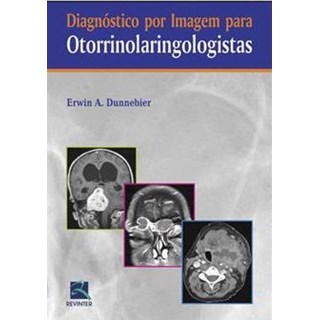 Livro - Diagnostico por Imagem para Otorrinolaringologistas - Dunnebier