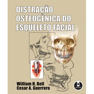 Livro - Distracao Osteogenica do Esqueleto Facial - Bell/guerrero