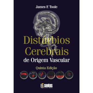 Livro - Disturbios Cerebrais - De Origem Vascular - Toole *** Livro - Disturbios Cerebrais - De Origem Vascular - Toole ***