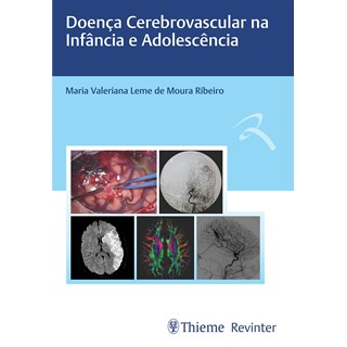 Livro - Doenca Cerebrovascular Na Infancia e Adolescencia - Ribeiro
