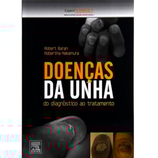 Livro - Doenças da Unha - Baran Livro - Doenças da Unha - Baran