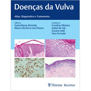 Livro Doenças da Vulva - Almeida - Revinter
