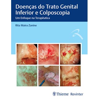 Livro Doenças do Trato Genital Inferior e Colposcopia - Zanine - Revinter