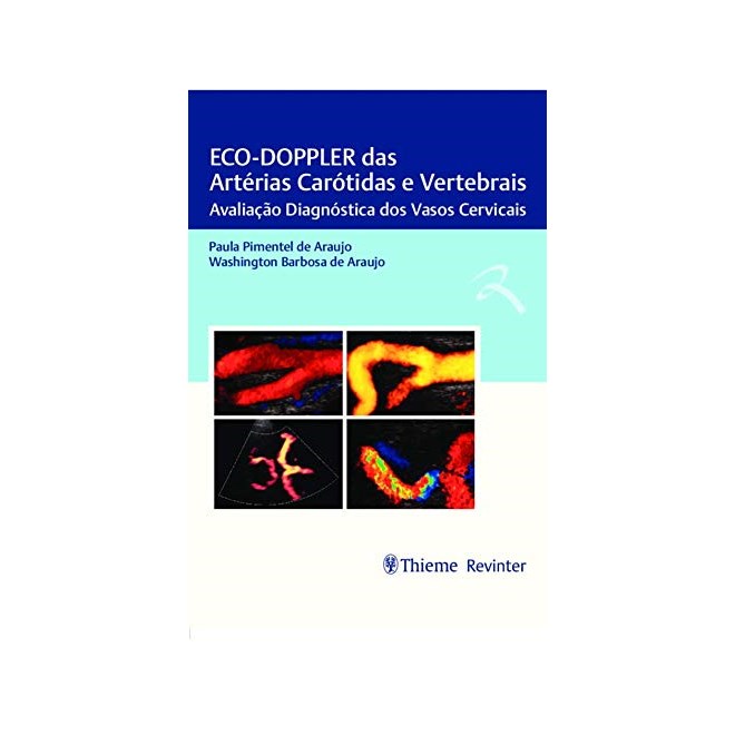 Livro - Eco-doppler das Arterias Carotidas e Vertebrais: Avaliacao Diagnostica dos - Araujo