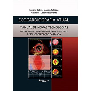 Livro - Ecocardiografia Atual - Manual de Novas Tecnologias - Belém