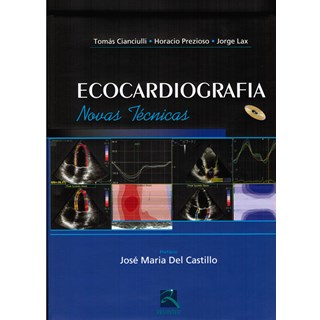 Livro - Ecocardiografia - Novas Técnicas - Castillo