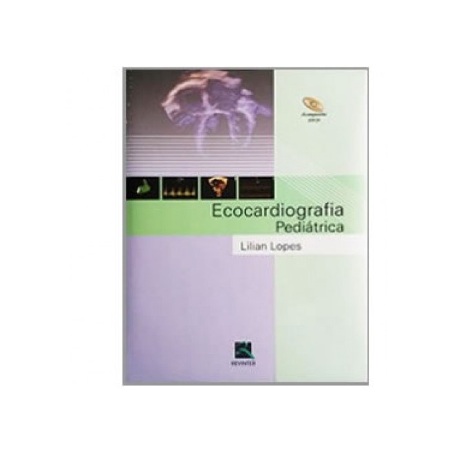 Livro - Ecocardiografia Pediatrica - Lopes
