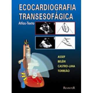 Livro - Ecocardiografia Transesofágica - Atlas e Texto - Assef