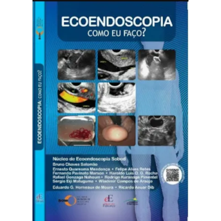 Livro - Ecoendoscopia Como Eu Faco - Salomao / Horneaux