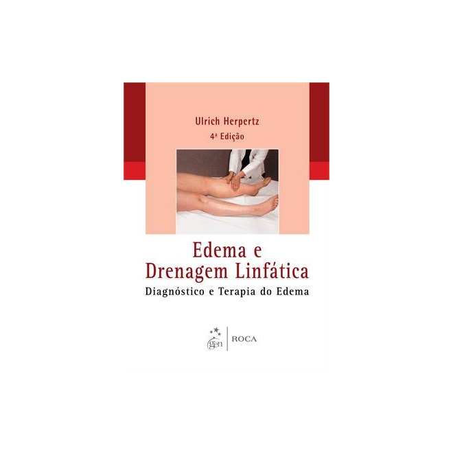 Livro - Edema e Drenagem Linfatica - Diagnostico e Terapia do Edema - Herpertz