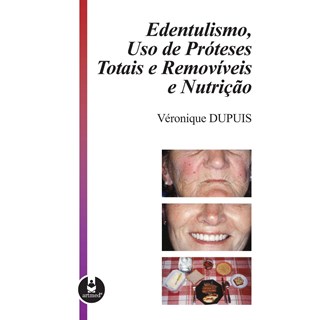 Livro - Edentulismo, Uso de Proteses Totais e Removiveis e Nutricao - Dupuis