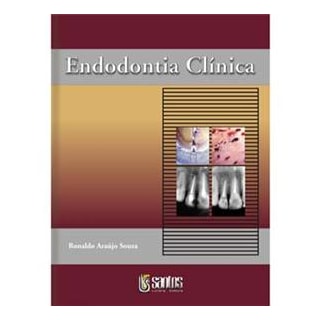 Livro - Endodontia Clínica - Souza Livro - Endodontia Clínica - Souza