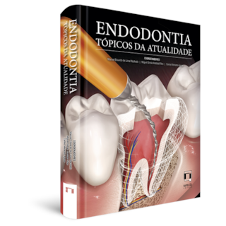 Livro - Endodontia Tópicos da Atualidade - Machado Livro - Endodontia Tópicos da Atualidade - Machado