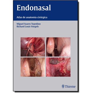 Livro - Endonasal - Atlas de Anatomia e Cirurgia Endoscópica dos Seios Paranasais - Tepedino