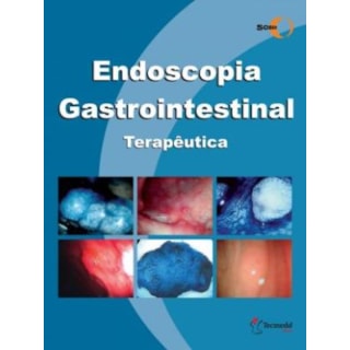 Livro - Endoscopia Gastrointestinal Terapêutica - SOBED Livro - Endoscopia Gastrointestinal Terapêutica - SOBED