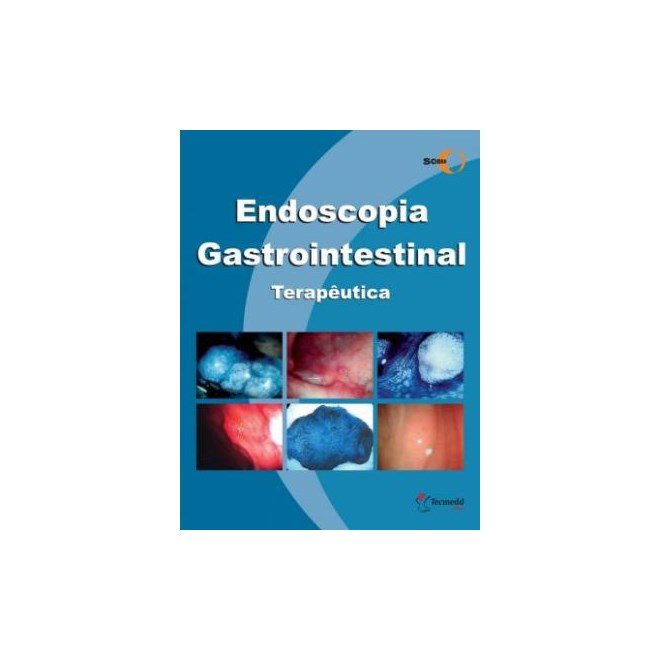 Livro - Endoscopia Gastrointestinal Terapeutica - Sobed - Parada/ Colaboradore