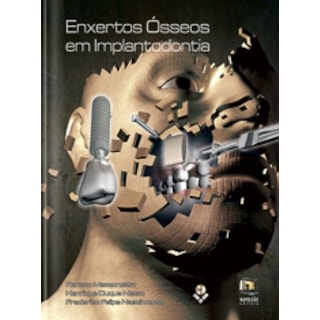 Livro - Enxertos Ósseos em Implantodontia - Mazzonetto Livro - Enxertos Ósseos em Implantodontia - Mazzonetto