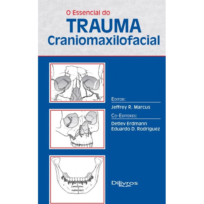 Livro - Essencial do Trauma Craniomaxilofacial, O - Marcus