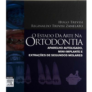 Livro - Estado da Arte Na Ortodontia, O - Trevisi/ Zanelato