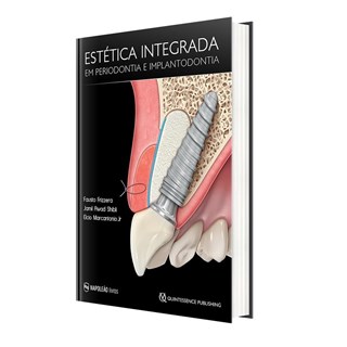 Livro - Estética Integrada em Periodontia e Implantodontia - Frizzera 1ª edição