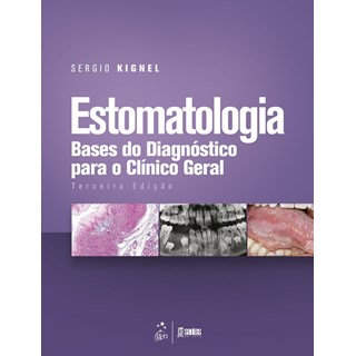 Livro - Estomatologia - Bases do Diagnostico para o Clinico Geral - Kignel