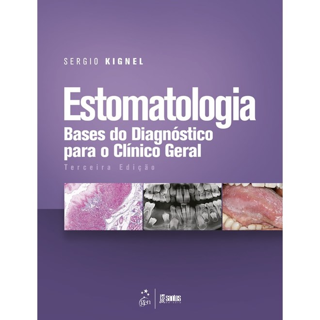Livro - Estomatologia - Bases do Diagnostico para o Clinico Geral - Kignel