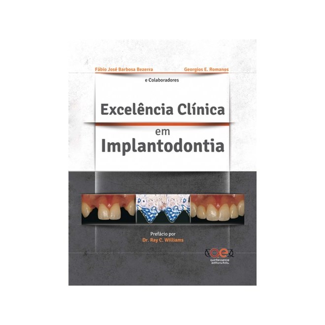Livro - Excelencia Clinica em Implantodontia - Bezerra/romanos