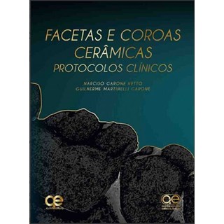 Livro - Facetas e Coroas Ceramicas - Protocolos Clinicos - Garone Neto/garone