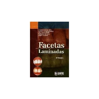 Livro - Facetas Laminada - Glauco Livro - Facetas Laminada - Glauco
