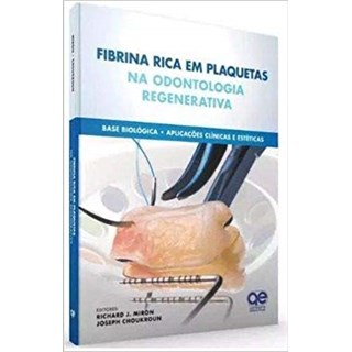 Livro - Fibrina Rica em Plaquetas na Odontologia Regenerativa - Base Biológica - Aplicações Clínicas e Estéticas - Miron - Santos