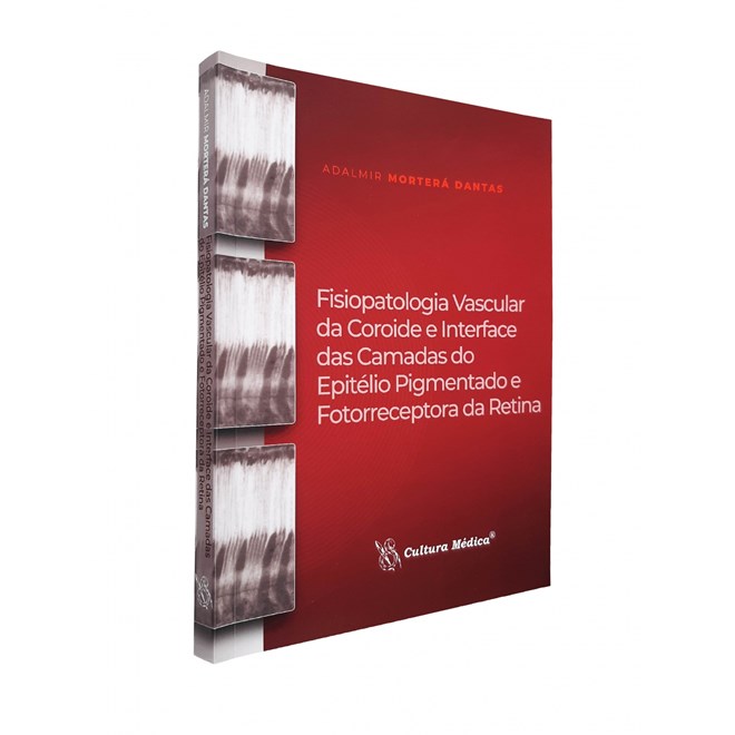 Livro Fisiopatologia Vascular da Coroide e Interface - Dantas - Cultura Médica