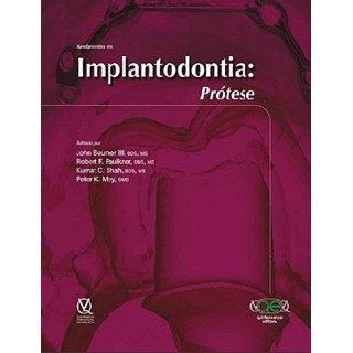 Livro - Fundamentos em Implantodontia: Prótese - Beumer III - Santos