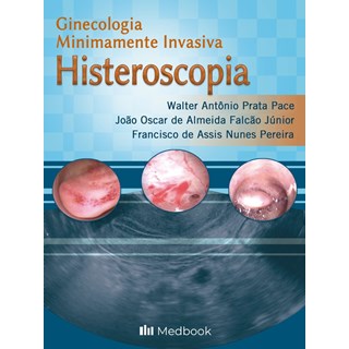 Livro Ginecologia Minimamente Invasiva Histeroscopia - Pace - Medbook