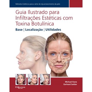 Livro - Guia Ilustrado para Infiltracoes Esteticas com Toxina Botulinica - Kane/satler