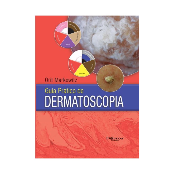 Livro - Guia Pratico de Dermatoscopia - Markowi