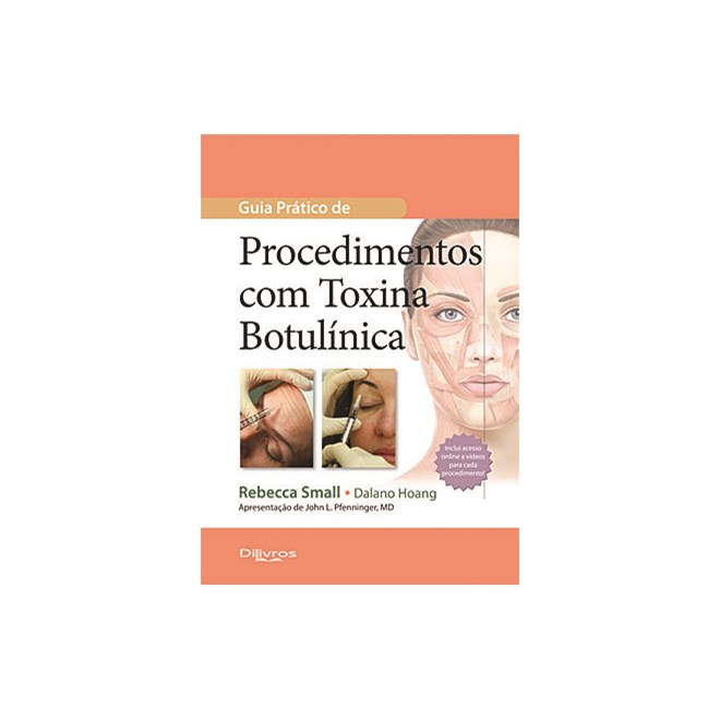 Livro - Guia Pratico de Procedimentos com Toxina Botulinica - Small/ Hoang