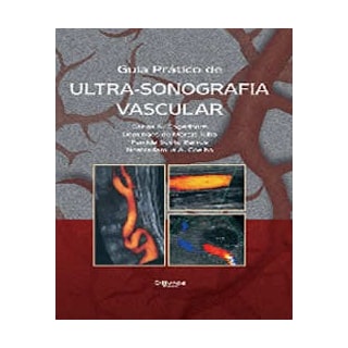 Livro - Guia Prático de Ultra-Sonografia Vascular - Engelhorn Livro - Guia Prático de Ultra-Sonografia Vascular - Engelhorn