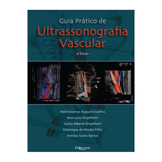 Livro - Guia Pratico de Ultrassonografia Vascular - Engelhorn/morais Fil