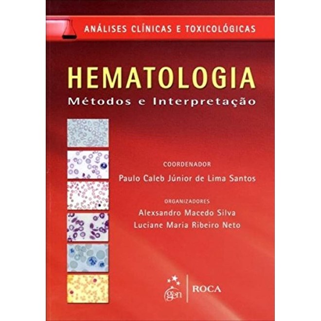 Livro Hematologia Métodos e Interpretação - Santos - Roca