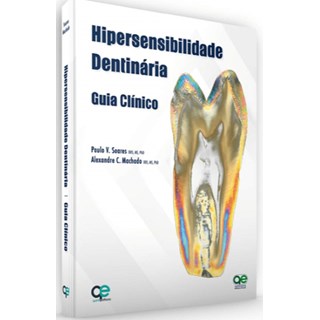 Livro - Hipersensibilidade Dentária - Guia Clínico - Soares