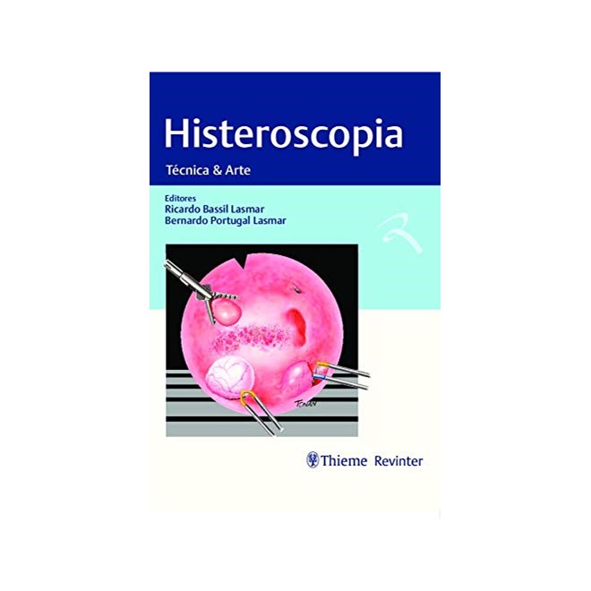 Livro - Histeroscopia - Lasmar