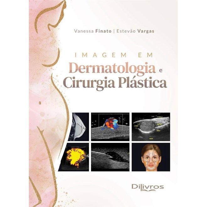 Livro - Imagem em Dermatologia e Cirurgia Plastica - Finato/vargas