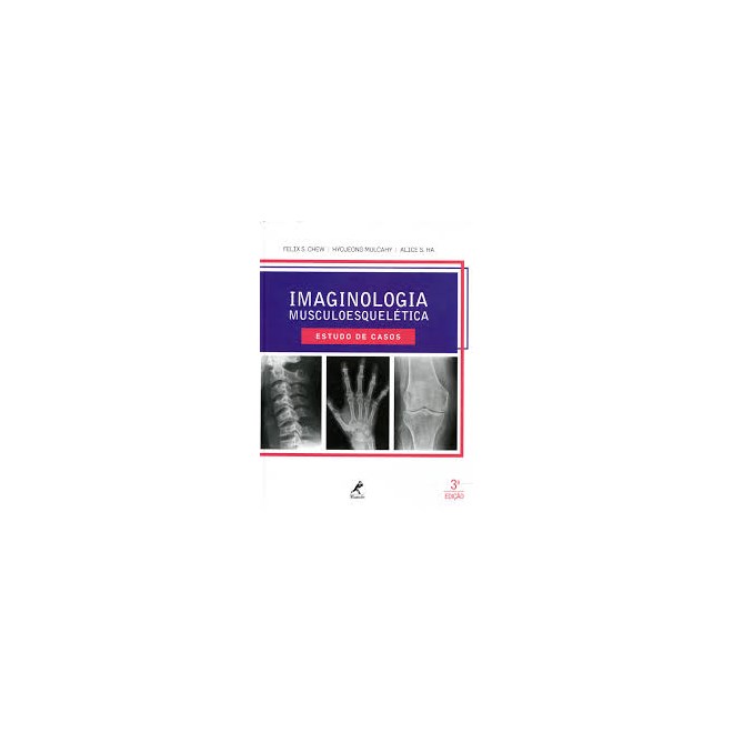 Livro - Imaginologia Musculoesqueletica - Estudo de Casos *** - Chew/mulcahy/ha
