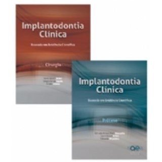 Livro - Implantodontia:  Clinica Baseada em Evidencias Cientificas -Vol 1 Cirurgia - Vol 2 Prótese - Shibli - Santos