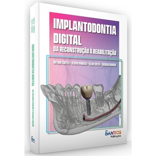 Livro - Implantodontia Digital: da Reconstrucao a Reabilitacao - Cortes