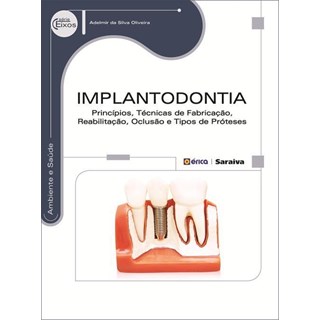 Livro Implantodontia Princípios, Técnicas de fabricação , Reabilitação, Oclusão e Tipos de Próteses - Oliveira